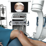 Arthroscopic Reconstruction of the Knee for Ligament Injuries