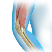 Elbow Tendon and Ligament Repair